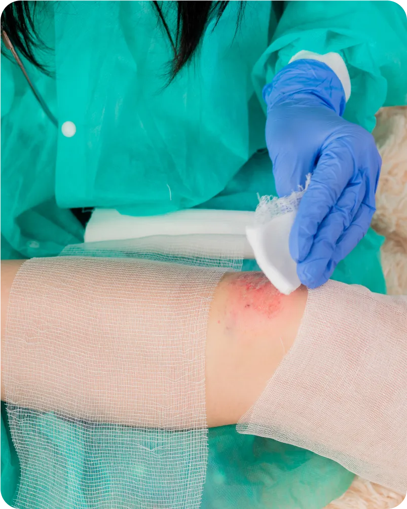 post surgical wound care