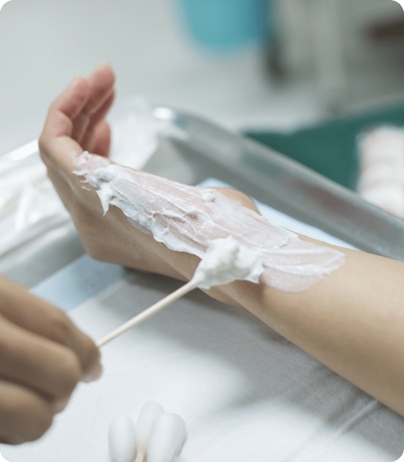 non healing burns and wound care treatment options