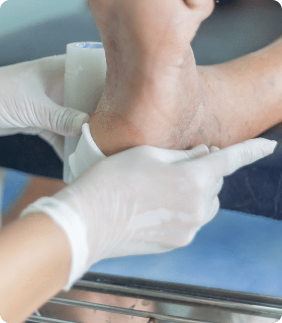 diabetic foot ulcers