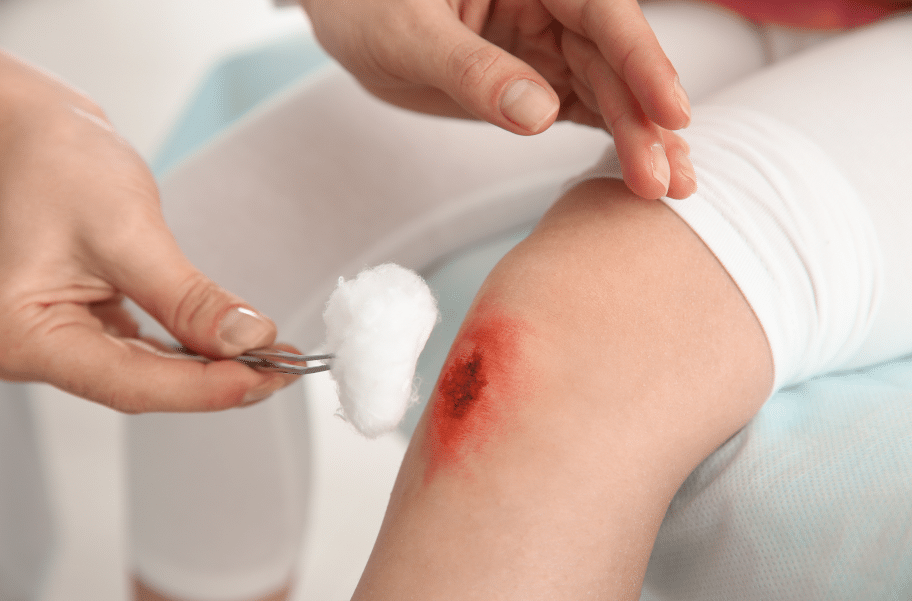 traditional wound care