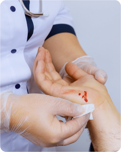 lacerations and wound healing