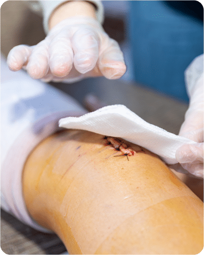 surgical wounds not healing on their own